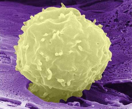 A stem cell emerging from rat bone marrow. By stimulating the release of stem cells after a heart attack, the healing process could be accelerated. Photograph: Imperial College London